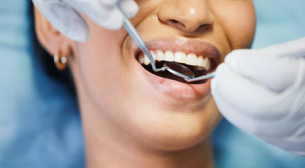 Best After-Hours Dental Trauma Care in Childress, TX