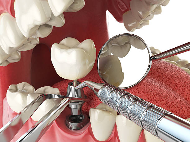 Best Emergency Dental Care for Broken or Chipped Teeth in Childress, TX